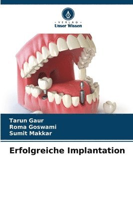 Erfolgreiche Implantation 1