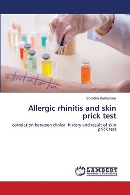 Allergic rhinitis and skin prick test 1