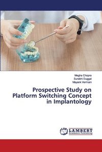 bokomslag Prospective Study on Platform Switching Concept in Implantology