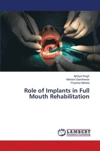 bokomslag Role of Implants in Full Mouth Rehabilitation