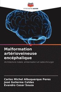 bokomslag Malformation artérioveineuse encéphalique