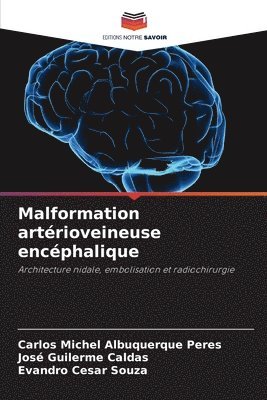 Malformation artérioveineuse encéphalique 1