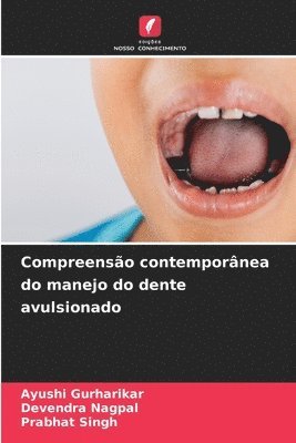 Ayushi Gurharikar, Devendra Nagpal, Prabhat Singh - Compreensão contemporânea do manejo do dente avulsionado, Häftad