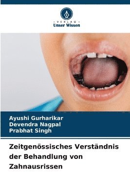 Ayushi Gurharikar, Devendra Nagpal, Prabhat Singh - Zeitgenössisches Verständnis der Behandlung von Zahnausrissen, Häftad