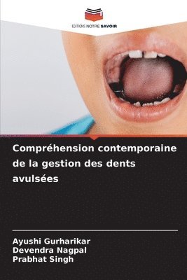 Compréhension contemporaine de la gestion des dents avulsées 1