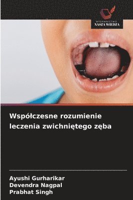 Ayushi Gurharikar, Devendra Nagpal, Prabhat Singh - Wspólczesne rozumienie leczenia zwichniętego zęba, Häftad