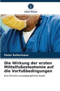 bokomslag Die Wirkung der ersten Mittelfuosteotomie auf die Vorfubedingungen