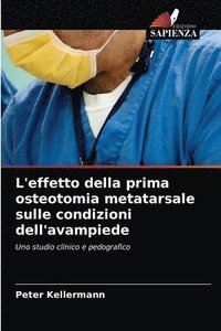 bokomslag L'effetto della prima osteotomia metatarsale sulle condizioni dell'avampiede