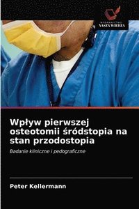 bokomslag Wplyw pierwszej osteotomii &#347;rdstopia na stan przodostopia