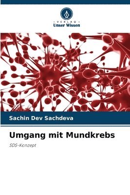 Sachin Dev Sachdeva - Umgang mit Mundkrebs, Häftad