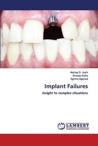 bokomslag Implant Failures