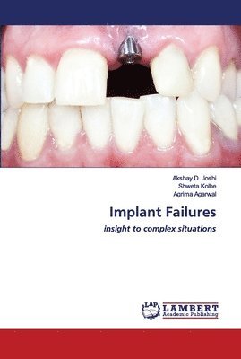 Implant Failures 1