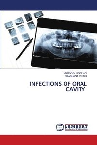 bokomslag Infections of Oral Cavity