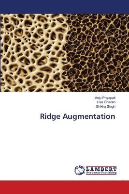 Ridge Augmentation 1