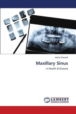Maxillary Sinus 1