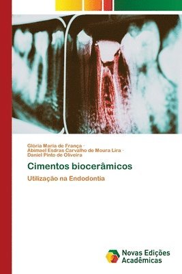 bokomslag Cimentos biocerâmicos
