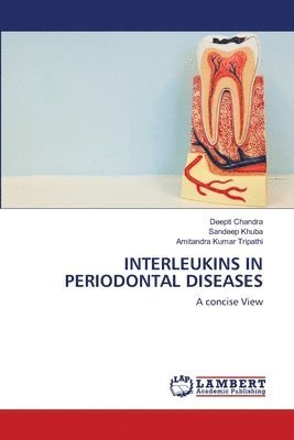 Interleukins in Periodontal Diseases 1