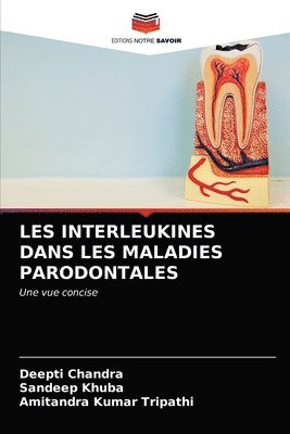 Les Interleukines Dans Les Maladies Parodontales 1