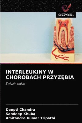 Interleukiny W Chorobach Przyz&#280;bia 1