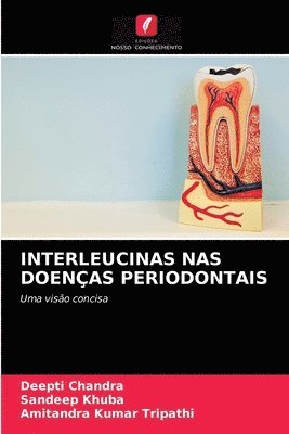 Interleucinas NAS Doenas Periodontais 1