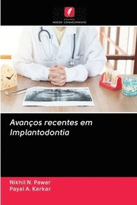 bokomslag Avanos recentes em Implantodontia