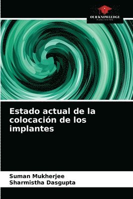 bokomslag Estado actual de la colocacin de los implantes