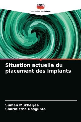 bokomslag Situation actuelle du placement des implants