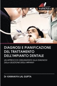 bokomslag Diagnosi E Pianificazione del Trattamento Dell'impianto Dentale