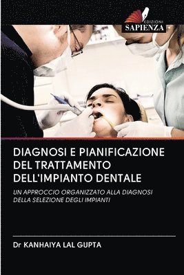 Diagnosi E Pianificazione del Trattamento Dell'impianto Dentale 1