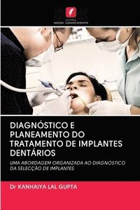 bokomslag Diagnstico E Planeamento Do Tratamento de Implantes Dentrios