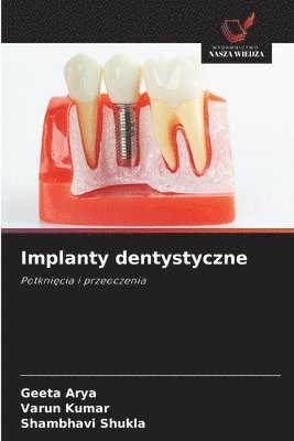 bokomslag Implanty dentystyczne