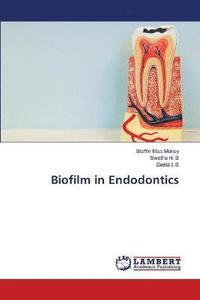 bokomslag Biofilm in Endodontics