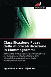 bokomslag Classificazione Fuzzy della microcalcificazione in Mammogrammi