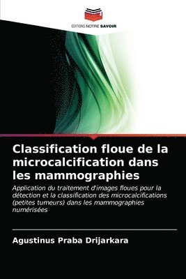 bokomslag Classification floue de la microcalcification dans les mammographies