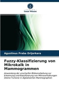 bokomslag Fuzzy-Klassifizierung von Mikrokalk in Mammogrammen