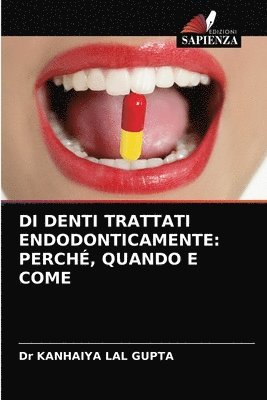 Di Denti Trattati Endodonticamente 1