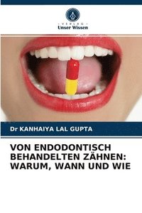 bokomslag Von Endodontisch Behandelten Zhnen