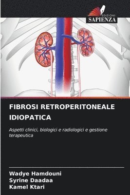 Fibrosi Retroperitoneale Idiopatica 1