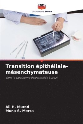 bokomslag Transition pithliale-msenchymateuse