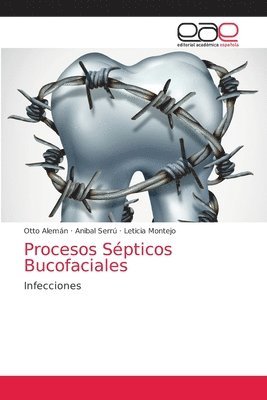 Procesos Septicos Bucofaciales 1