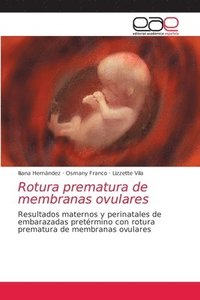 bokomslag Rotura prematura de membranas ovulares