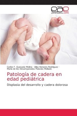 Patologa de cadera en edad peditrica 1