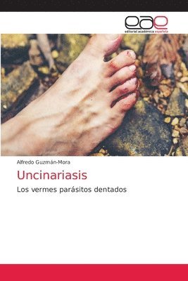 Uncinariasis 1