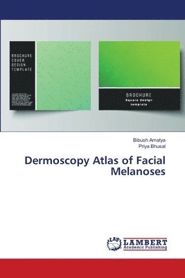 Dermoscopy Atlas of Facial Melanoses 1