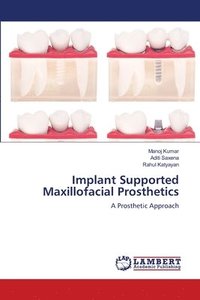 bokomslag Implant Supported Maxillofacial Prosthetics