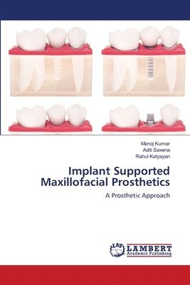 bokomslag Implant Supported Maxillofacial Prosthetics