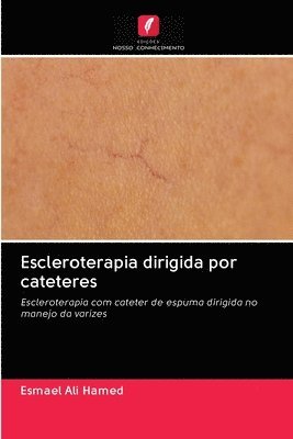 bokomslag Escleroterapia dirigida por cateteres