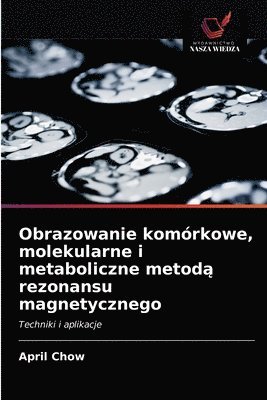 Obrazowanie komorkowe, molekularne i metaboliczne metod&#261; rezonansu magnetycznego 1