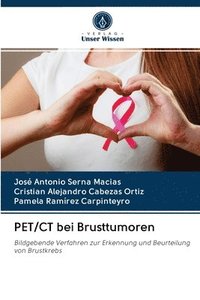 bokomslag PET/CT bei Brusttumoren