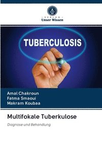 bokomslag Multifokale Tuberkulose